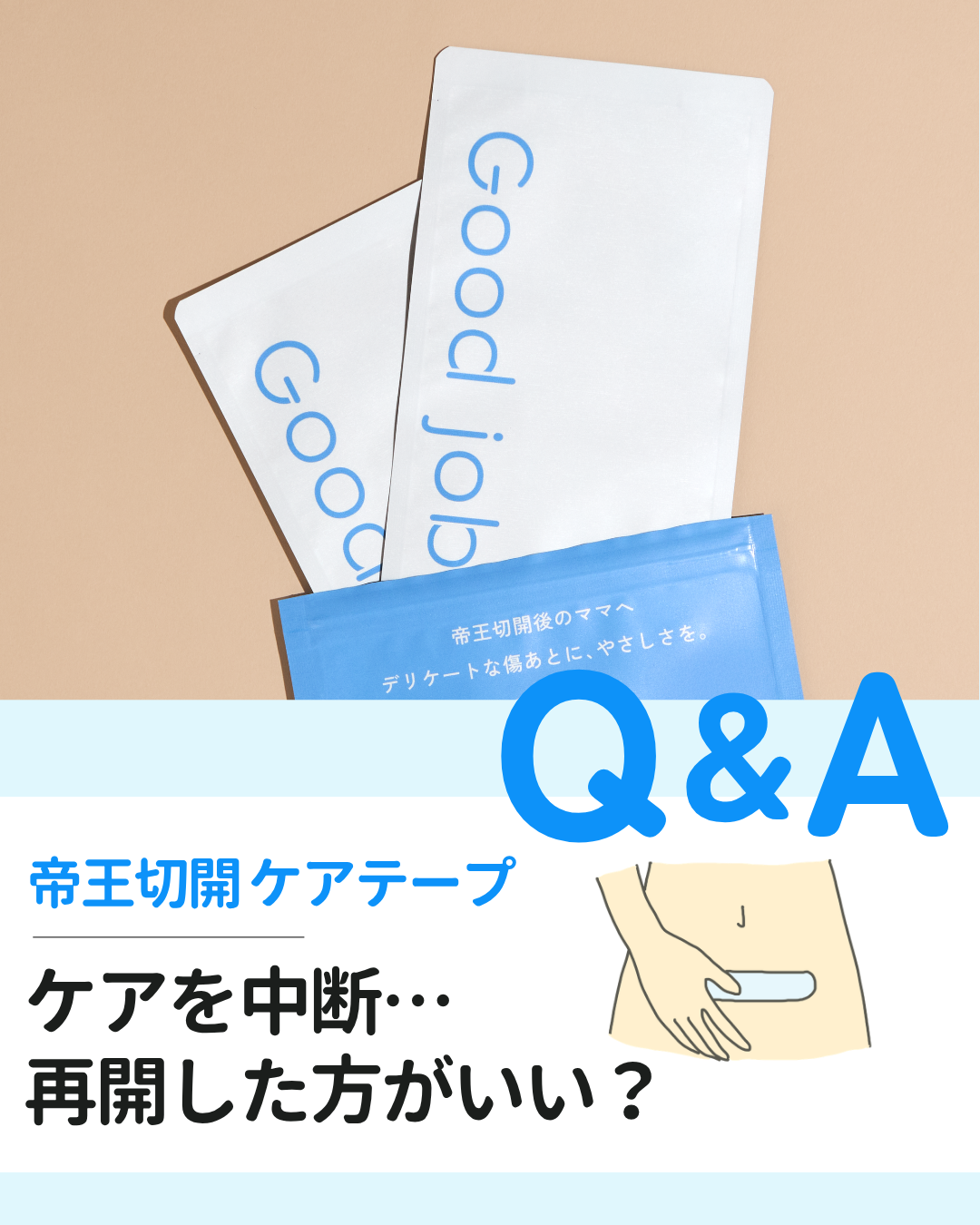 【Q&A】帝王切開の傷あとケアを中断…今からでも再開した方がいい?