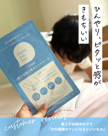 帝王切開の傷あとケアテープ|「夏はひんやりピタッと気持ちいい」お客様の口コミ