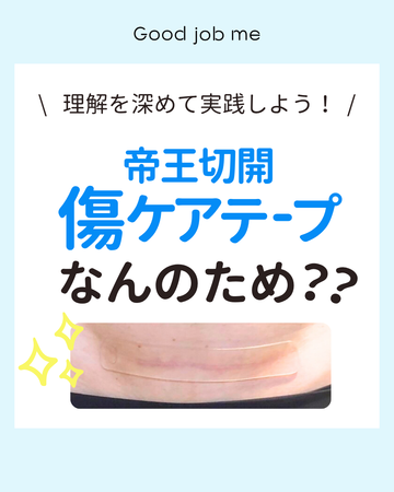 帝王切開の傷あとケアテープはなぜ必要？目的・効果・正しい使い方を解説