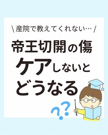 帝王切開の傷 ケアしないとどうなる？