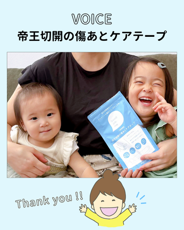 絆創膏タイプと全然違う！ケロイド体質の私でも手放せないテープ…！２度の帝王切開をご経験したママの声をご紹介