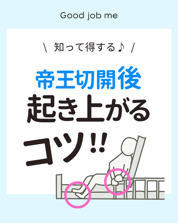 帝王切開後に起き上がるコツ｜ベッドから立つ方法と術後すぐ歩く理由