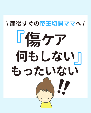 傷あとケア、何もしないのはもったいない!帝王切開後の後悔をなくすために