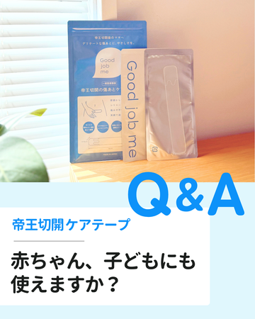 赤ちゃん・子どもにも使える？帝王切開ケアテープGood job meの安全性と実例紹介