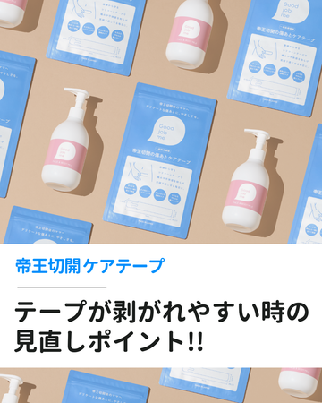 帝王切開ケアテープが剥がれやすい原因と対策｜保湿剤・貼り方の見直しポイント