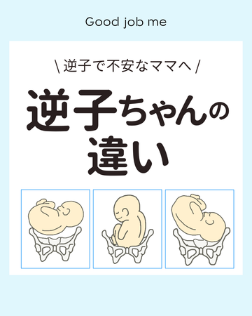 逆子ちゃんには種類がある?骨盤位・横位・斜位の違いを解説