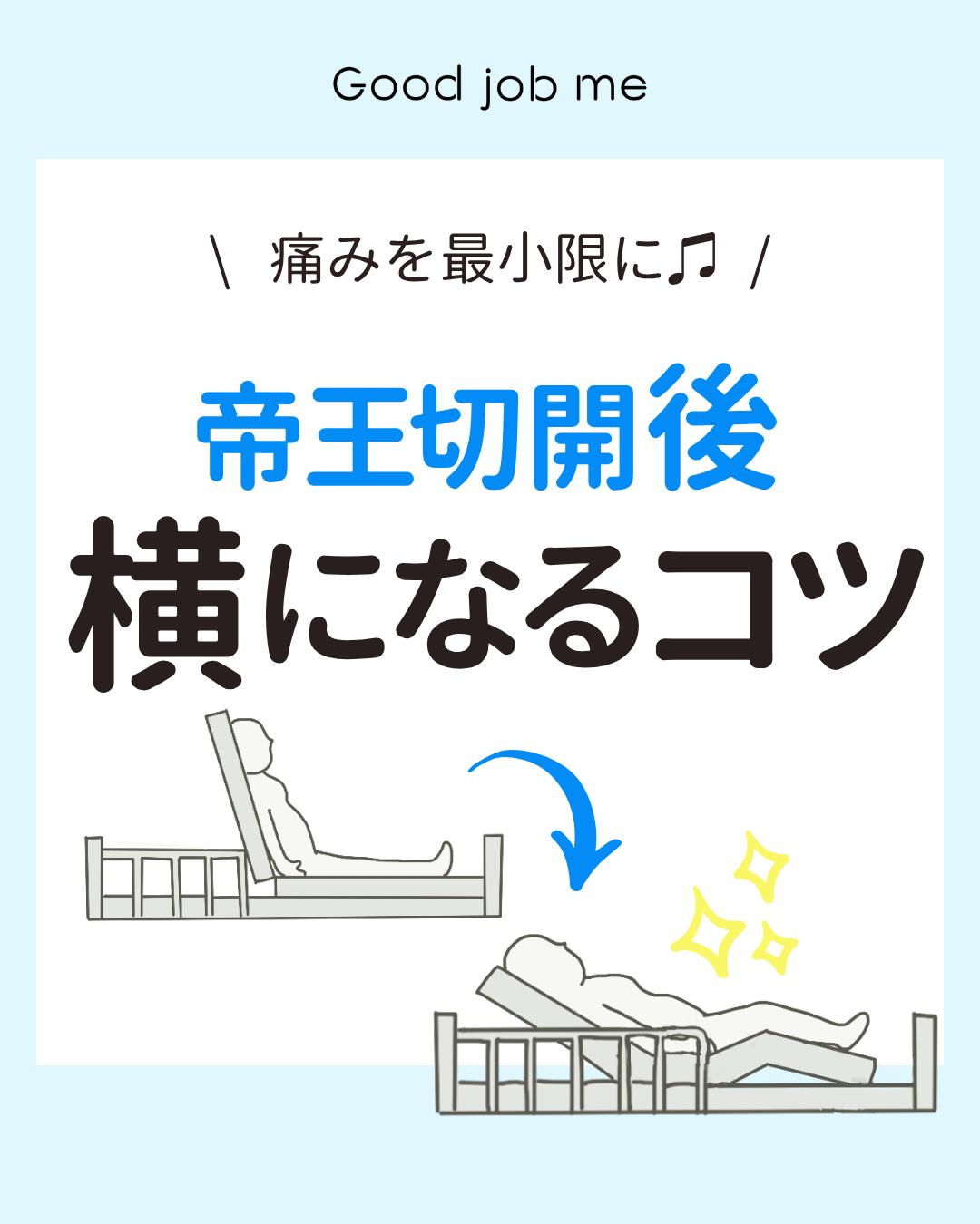 帝王切開後に横になる時のコツを紹介する投稿。腹筋を使わず、ベッドに深く腰掛ける→上半身をあずける→足を上げる→横になる4ステップをイラスト付きで解説。座る姿勢や授乳時のポイントも掲載。