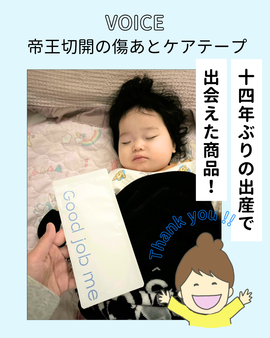 帝王切開の傷あとケアテープ｜14年ぶりの出産で選ばれた理由【体験談】
