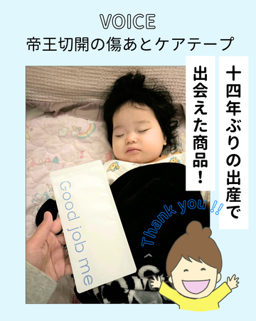 【お客様の声】14年ぶりの出産で選ばれた、傷あとケアテープ｜Good job me