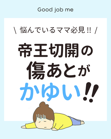 帝王切開の傷あとがかゆい!悩んでいるママ必見|原因と対処法まとめ