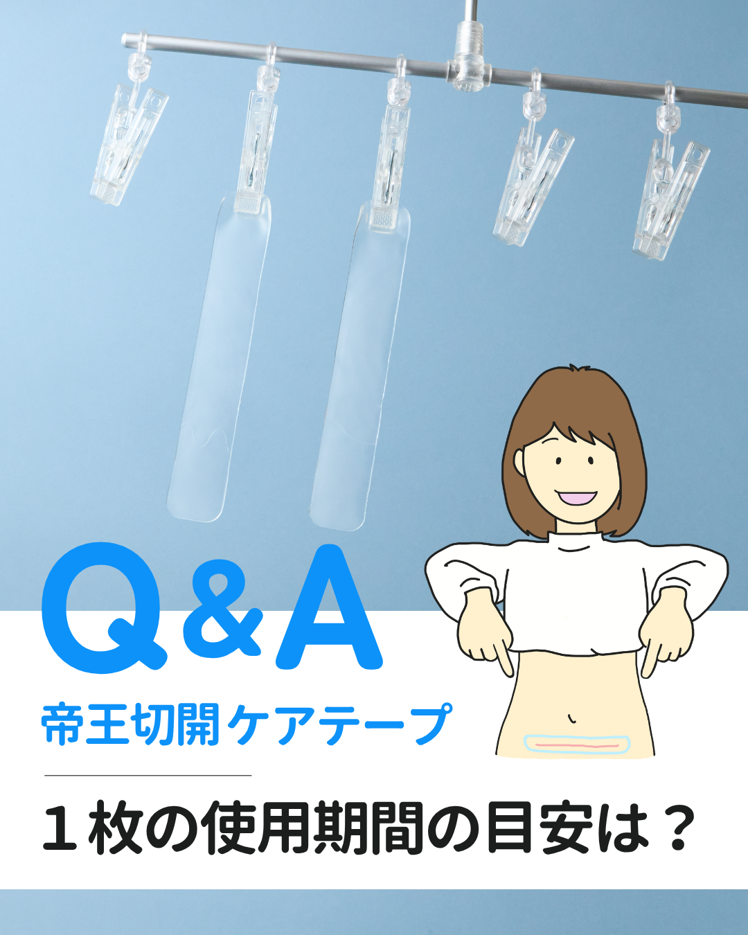 帝王切開ケアテープの使用期間の目安と交換タイミングを解説。1枚あたり約14〜28日を目安に、粘着力や汚れの状態に応じて交換する方法を紹介。