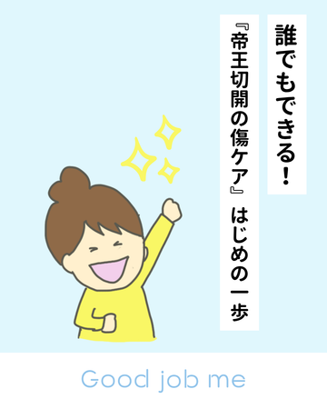 誰でもできる！帝王切開の傷あとケア「はじめの一歩」