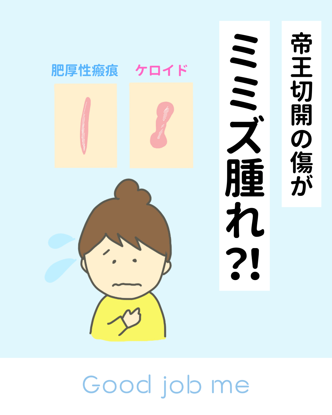 帝王切開の傷が赤くなる理由やミミズ腫れになる原因、予防方法をわかりやすく解説した